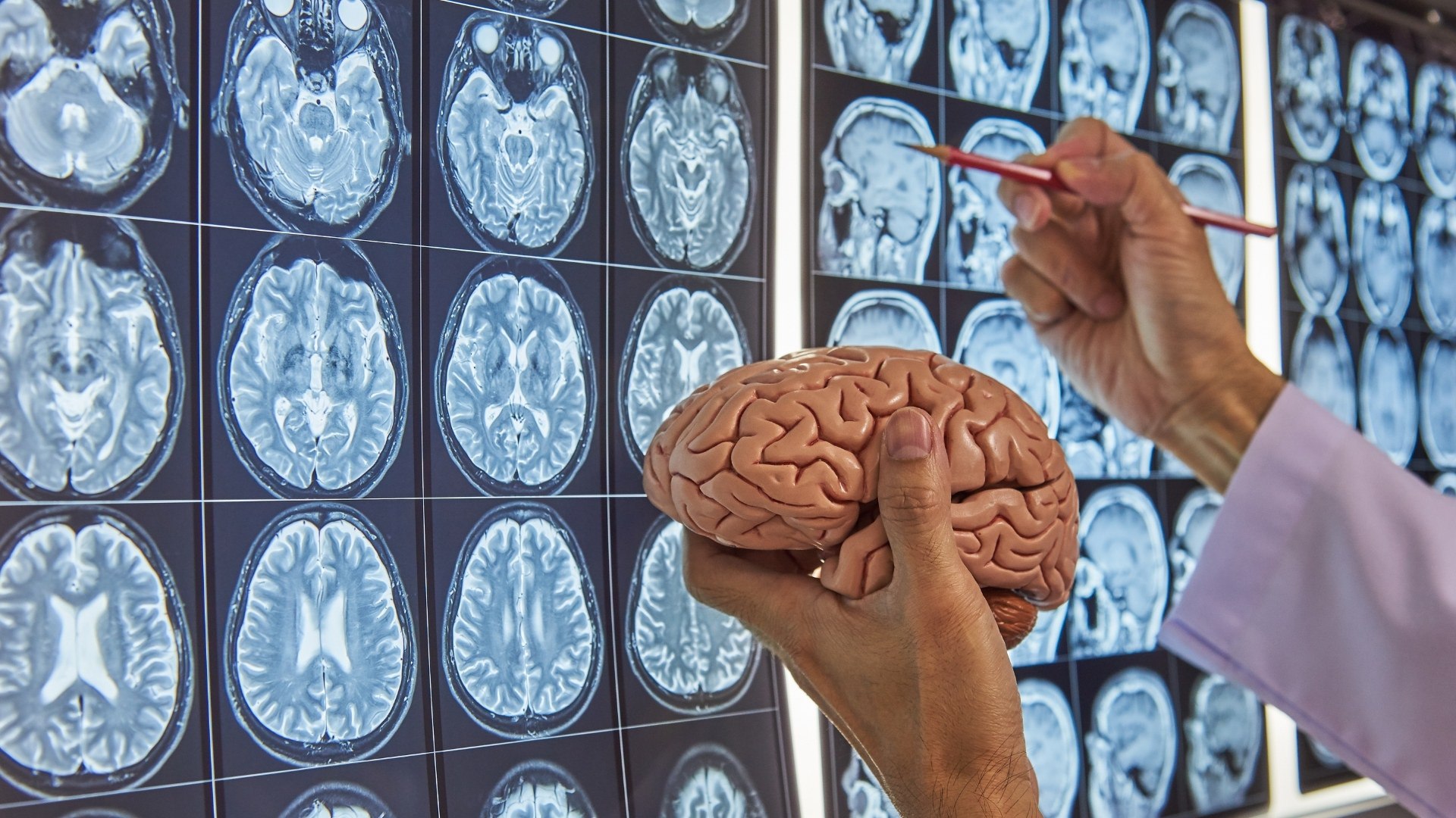 Polución y desigualdad aceleran el envejecimiento cerebral