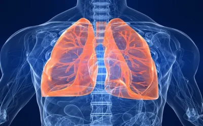 ¿Cuáles son los síntomas de la inflamación pulmonar?
