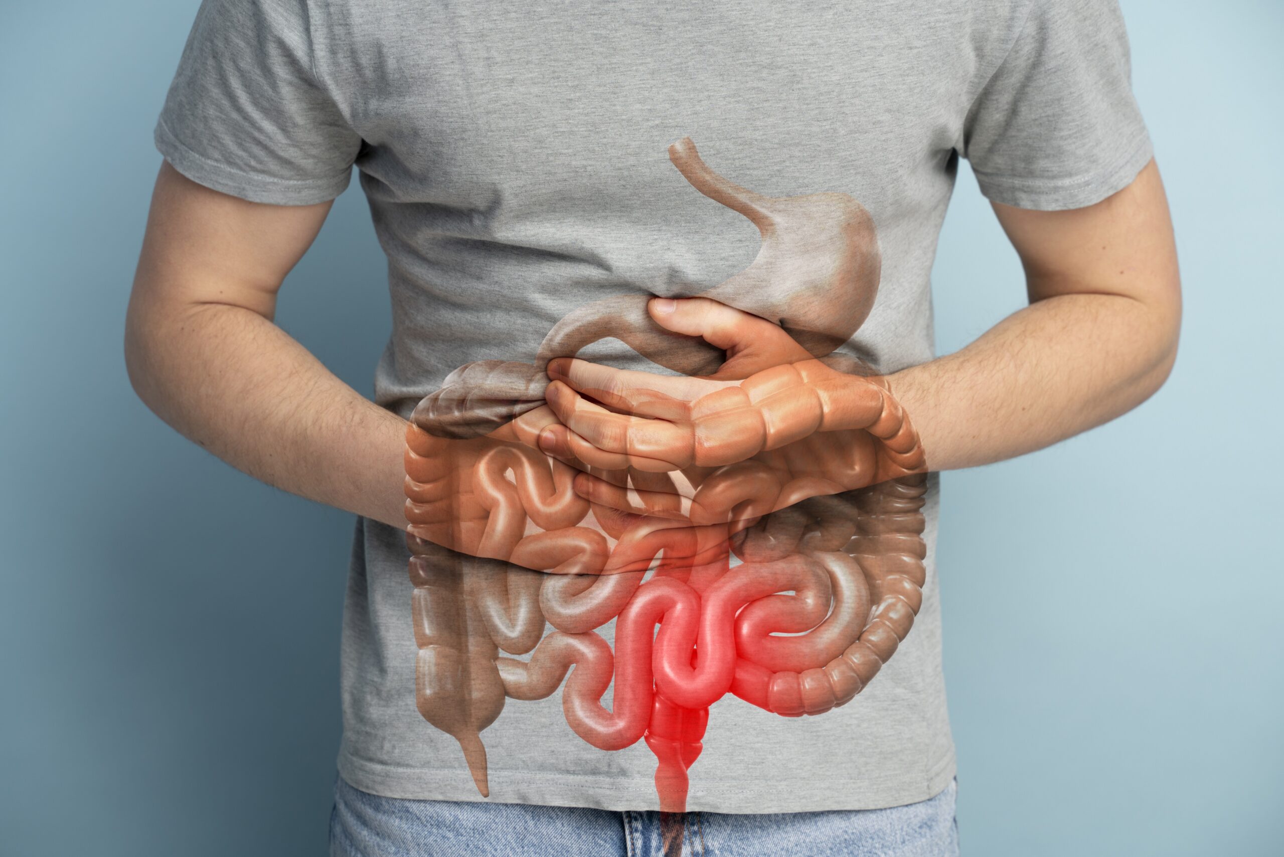 Cáncer de colon: síntomas y medidas que no se deben ignorar