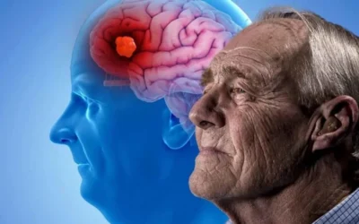 El debate sobre los nuevos tratamientos para el alzheimer