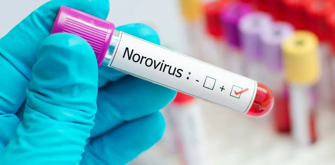 El norovirus, el nuevo virus que amenaza desde China
