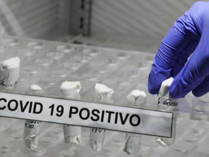 Colombia reportó 2.021 nuevos casos de Covid-19 Hoy