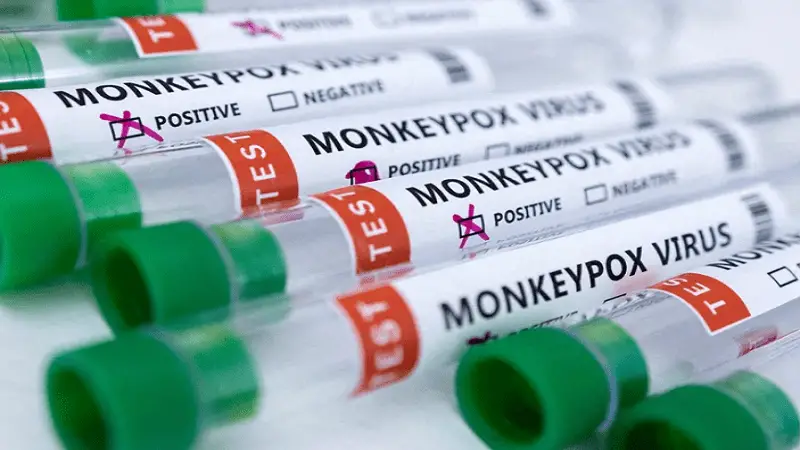 MinSalud emitió lineamientos a las EPS para controlar la viruela del mono