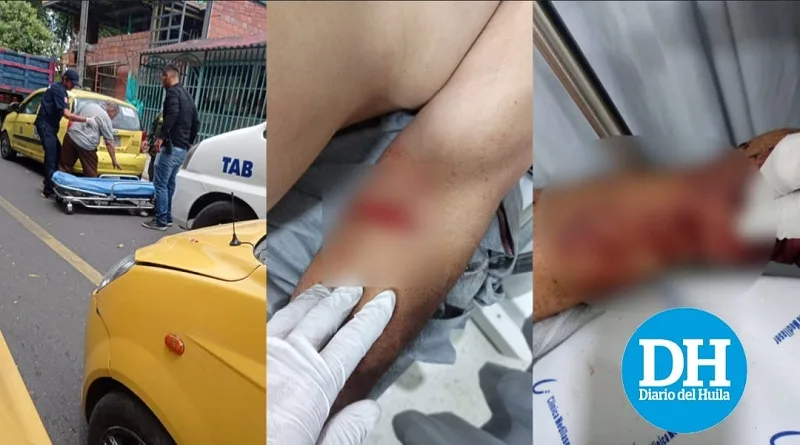 Taxista fue herido en medio de un robo en el norte de Neiva