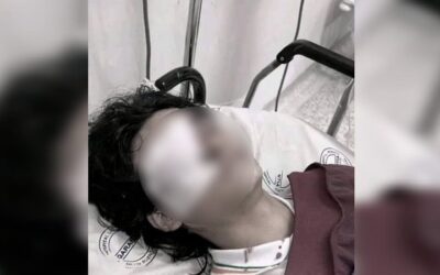 Estudiante perdió un ojo tras ser agredido por un compañero en colegio de Pitalito