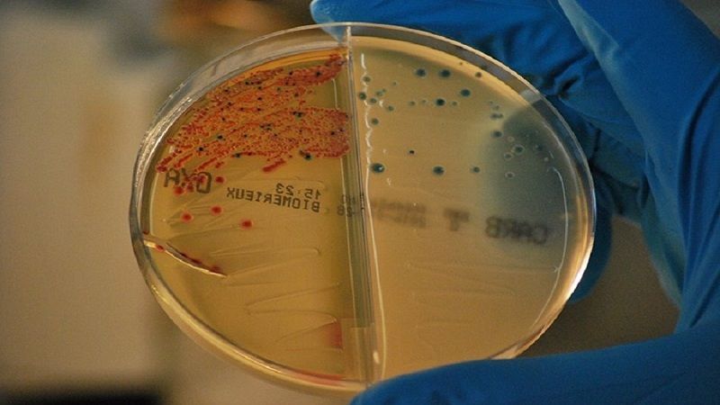 Las bacterias resistentes a los antibióticos están causando varias muertes