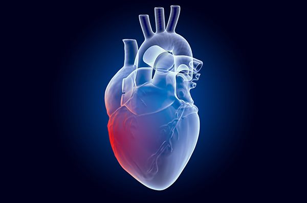 Mortalidad por riesgo cardiovascular