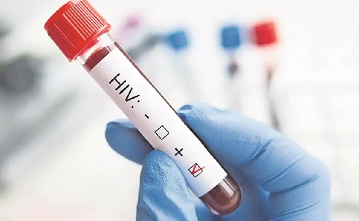 Vigilancia epidemiológica del VIH en el Huila